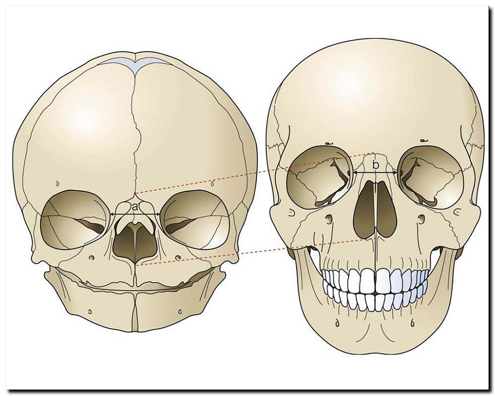 Crecimiento Y Desarrollo Craneofacial Mind Map