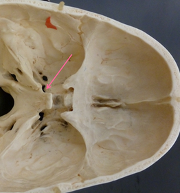 anatomy - neurocranium | Flashcards