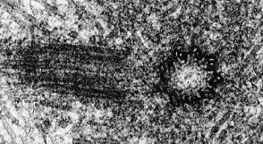 Resultado de imagen de imagenes organulos microscopio electronico