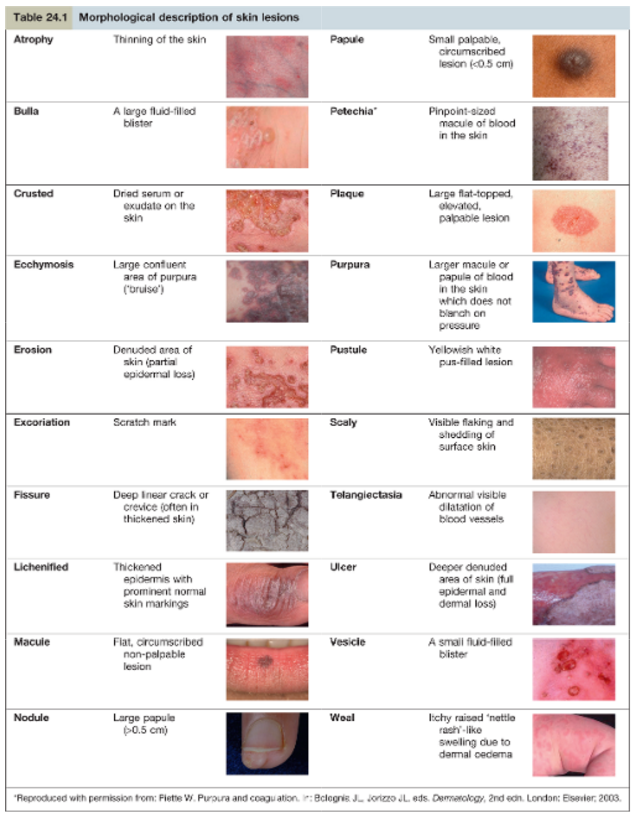 Morphological description of skin lesions | Note