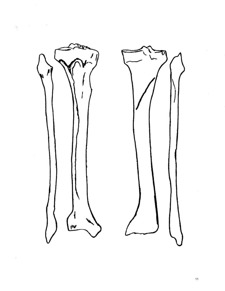 tibia and fibula | Quiz