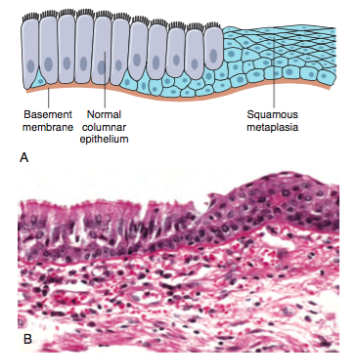 Histology CLINICAL POINTS Exam One | Flashcards