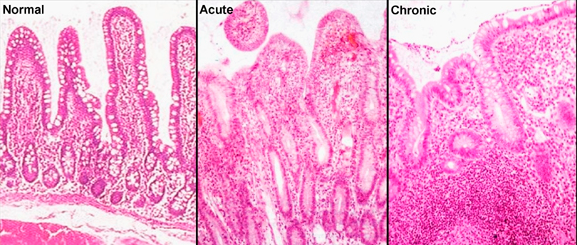 Histology CLINICAL POINTS Exam One | Conjunto de Fichas