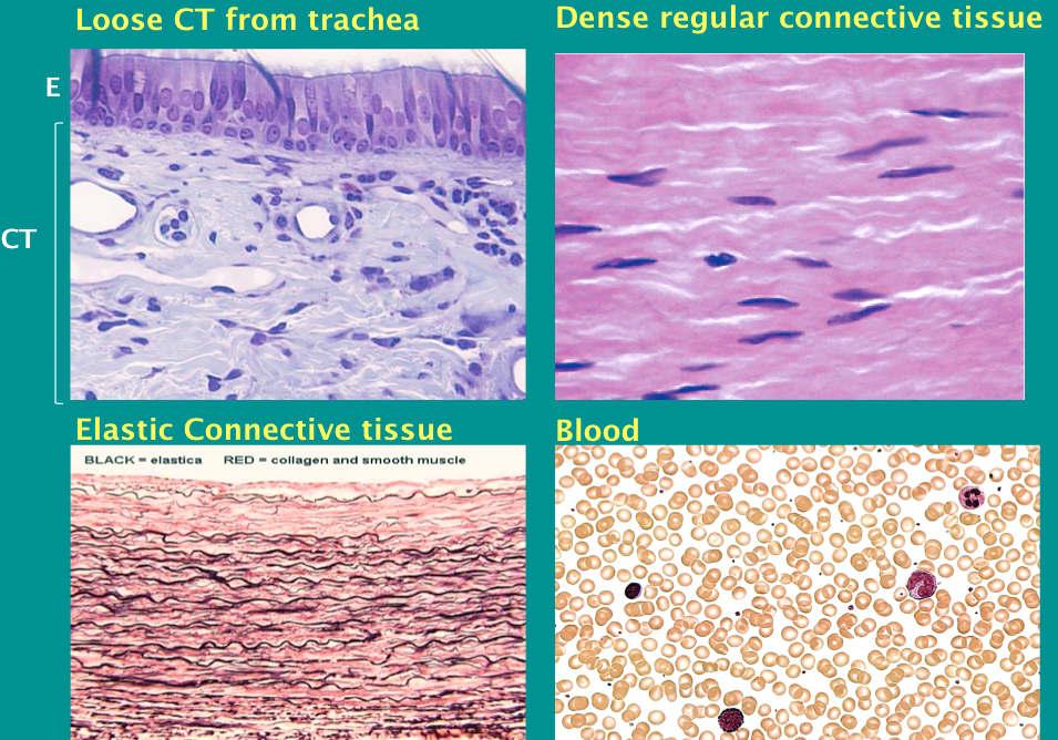loose connective tissue labeled matrix