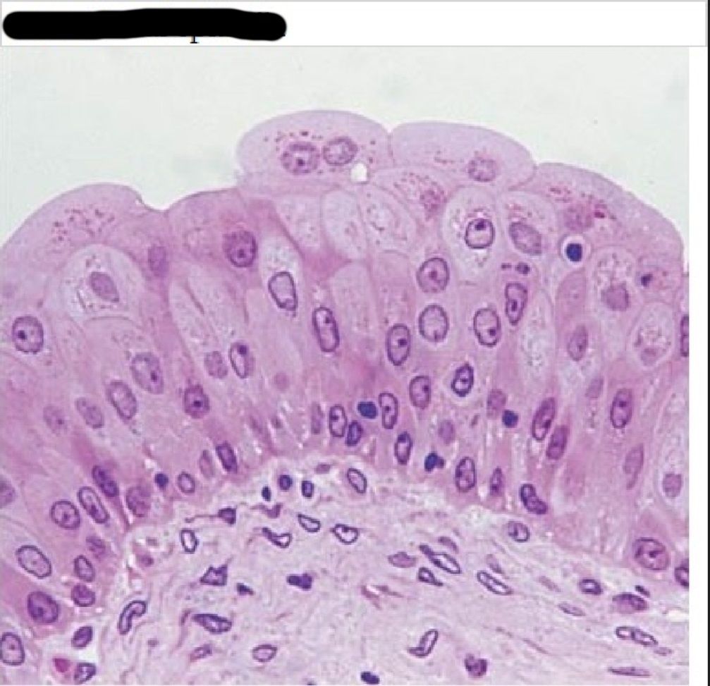 Клетки слизистой полости рта. Эпителиальные клетки гистология препарат. Мерцательный эпителий гистология. Переходный эпителий уротелий. Эпителиальные реснитчатый гистология.