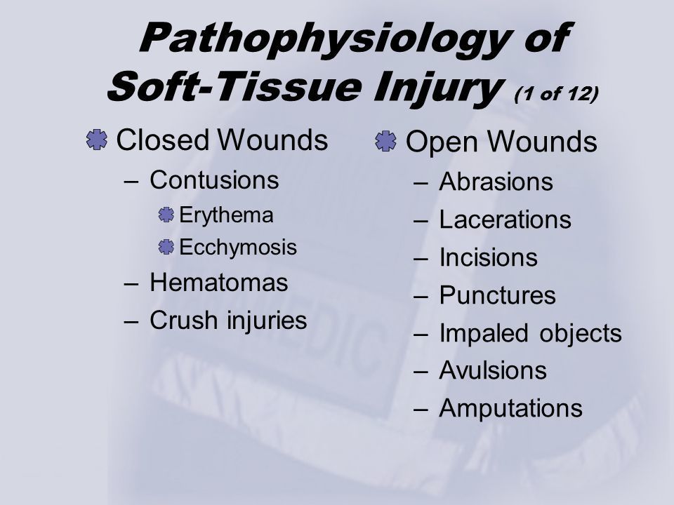 Soft Tissue (Sherpath Notes) | Note