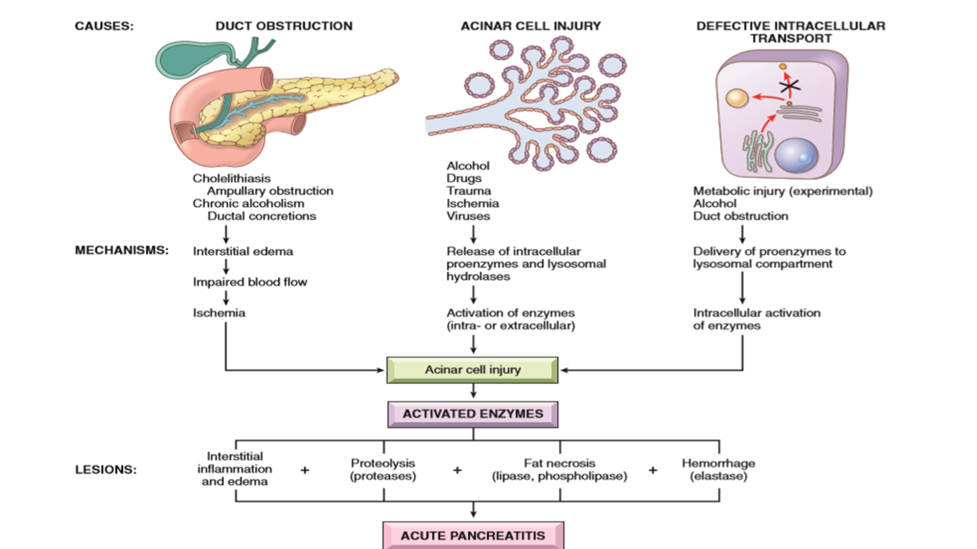 acute abdomen | Mind Map