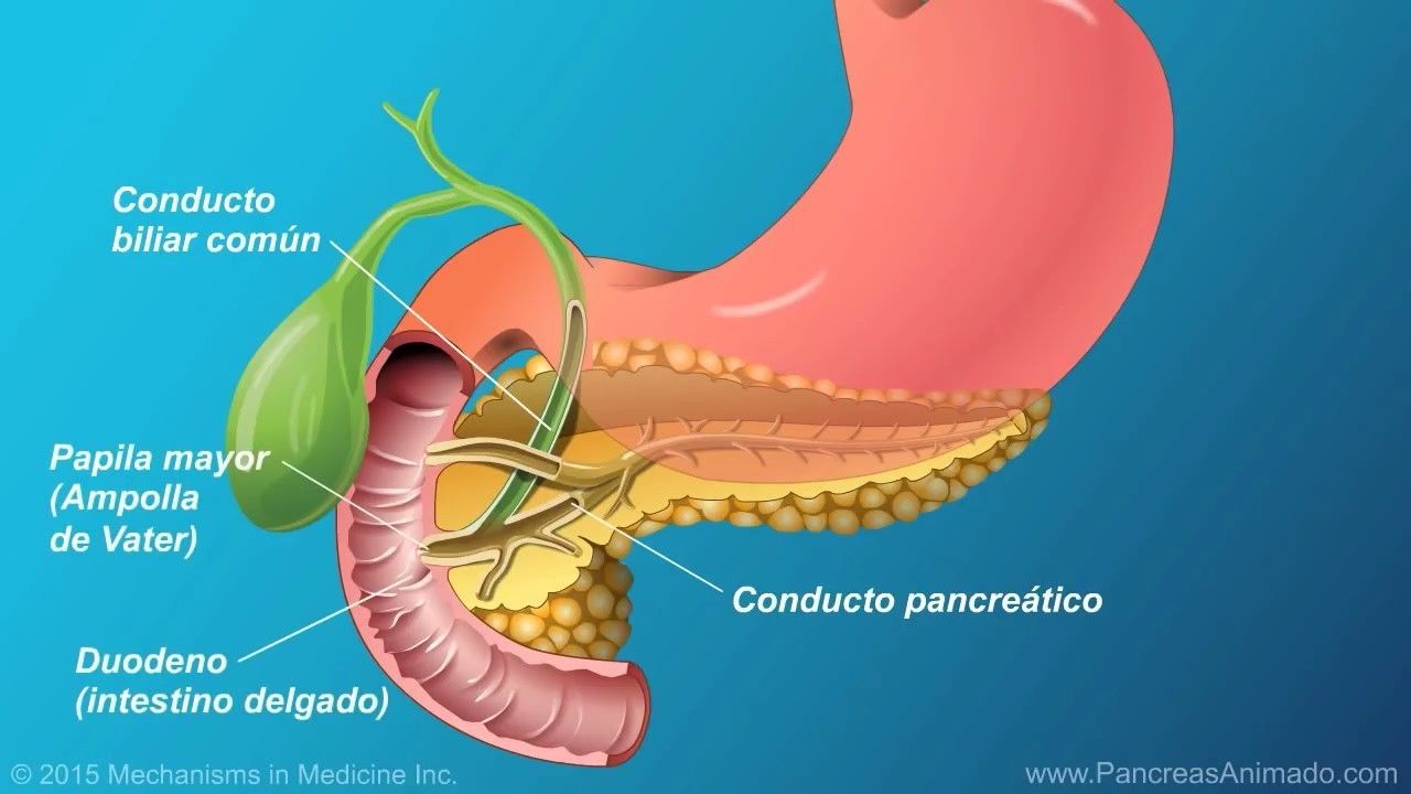 Pancreatitis. | Mind Map