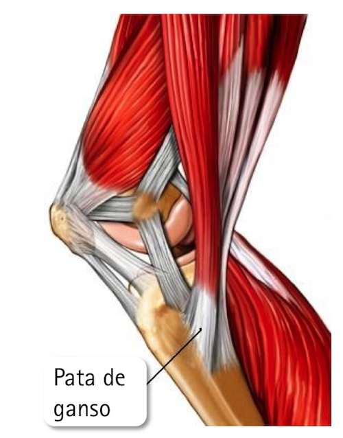 Бурсит сухожилия гусиной лапки коленного сустава. Бурсит гусиной лапки коленного сустава анатомия. Тендинит сухожилия подколенной мышцы. Бурсит гусиной лапки коленного сустава.