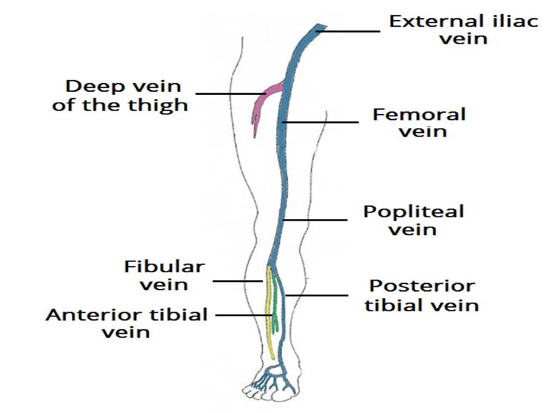 Peripheral vascular diseases | Mind Map