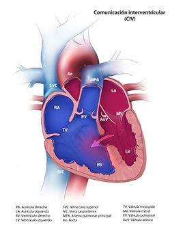 CARDIOPATIAS CONGÉNITAS | Mind Map