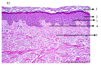 TEMA 1 DERMA | Quiz