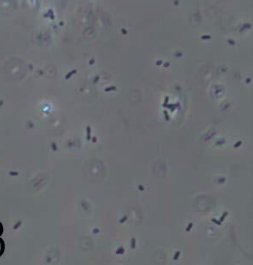 Urine Sediment Plates | Flashcards