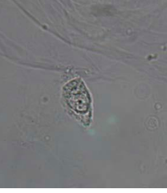 Urine Sediment Plates | Flashcards