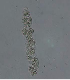 Urine Sediment Plates | Flashcards