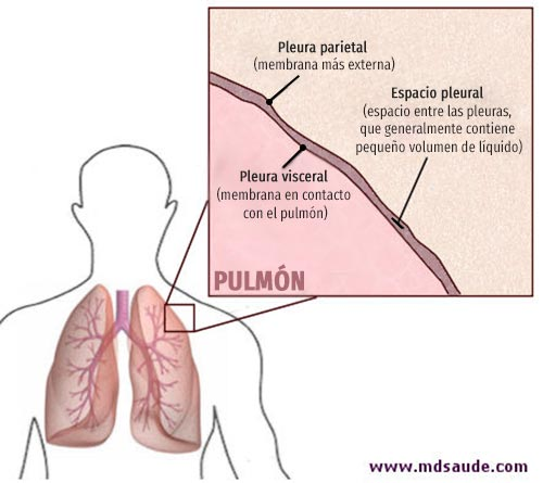 LÍQUIDO PLEURAL | Mind Map