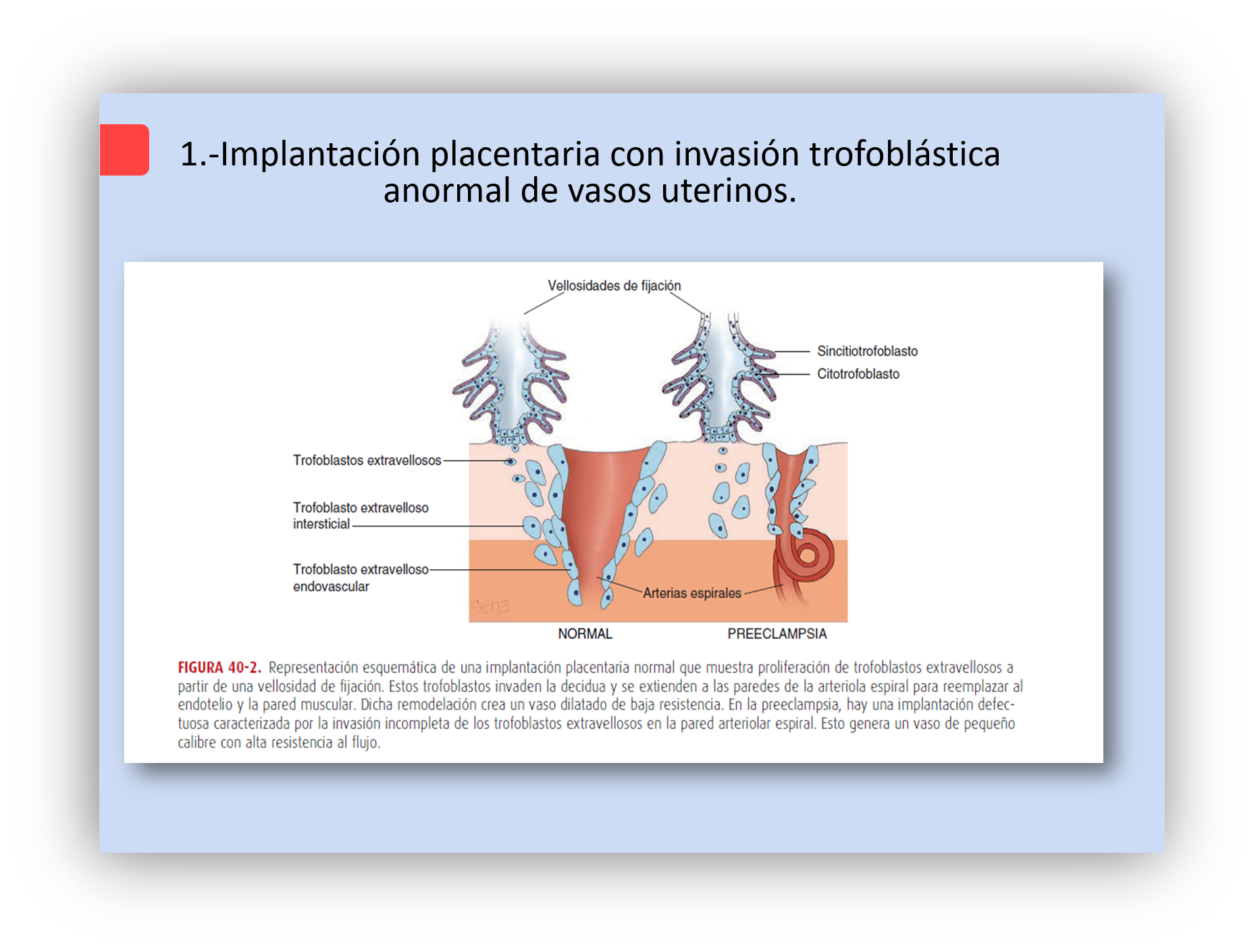 Trastornos Hipertensivos En El Embarazo | Mind Map