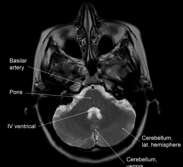 Neuroanatomy 