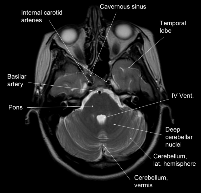 Neuroanatomy | Flashcards