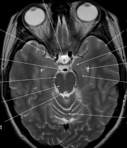 Neuroanatomy | Flashcards