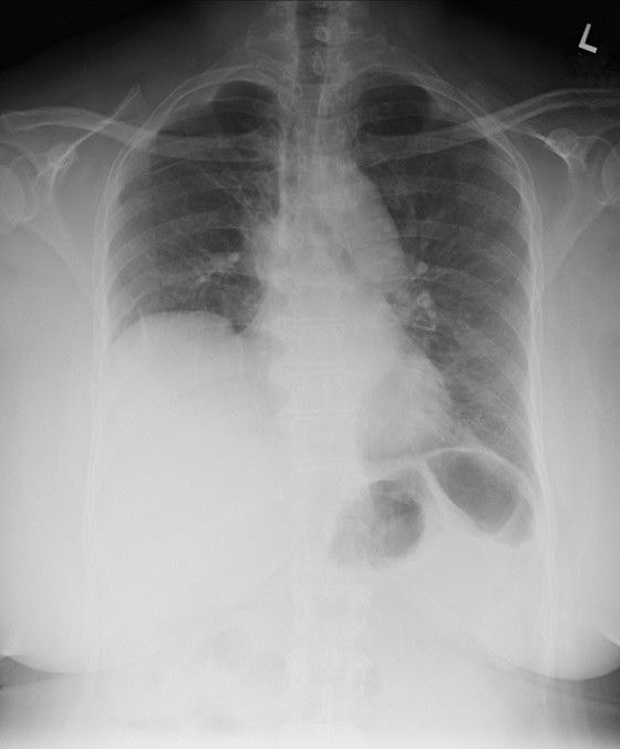 Sesats 12 - General Thoracic 