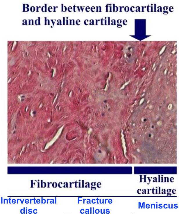 Msk Histology (bone, Cartilage, Ct & Muscle) 