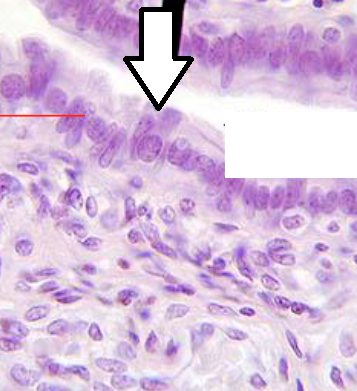 Female (Histology) | Flashcards