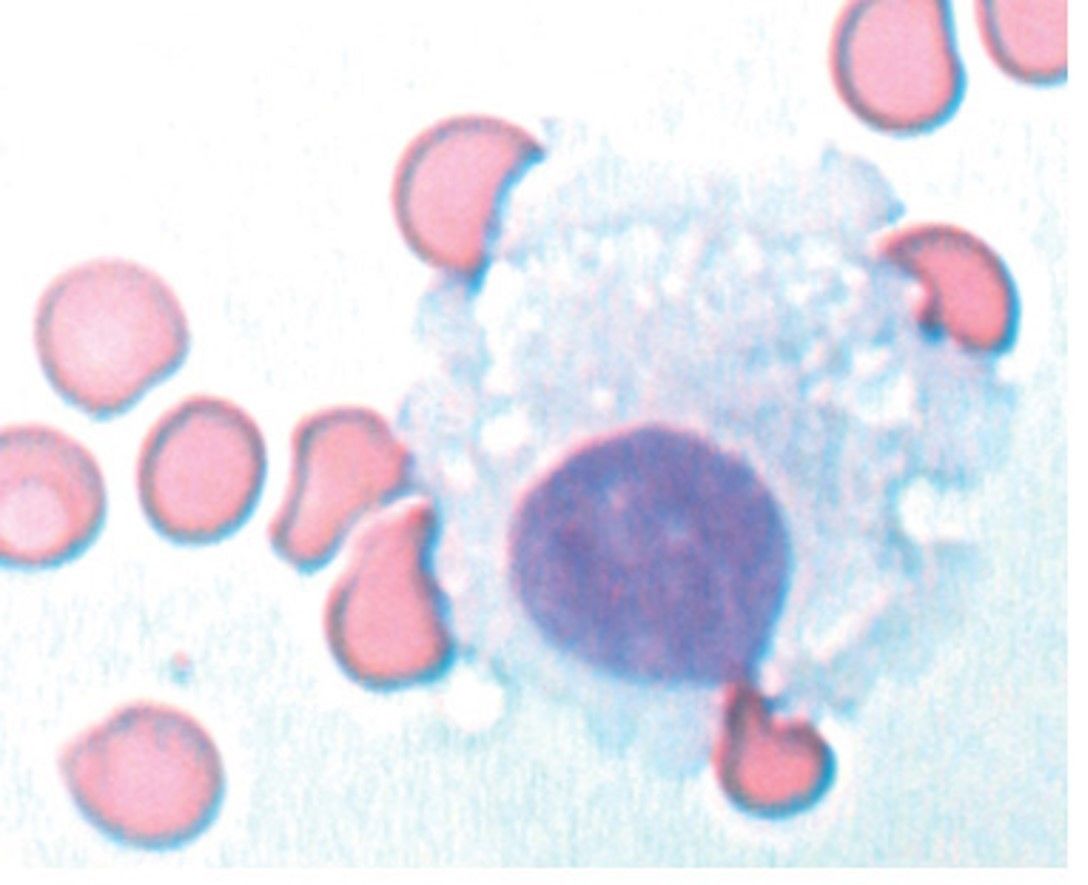 CSF cells Practical 1 | Flashcards