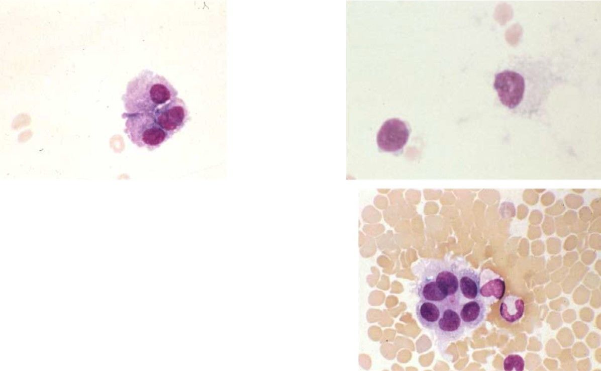 CSF cells Practical 1 | Flashcards