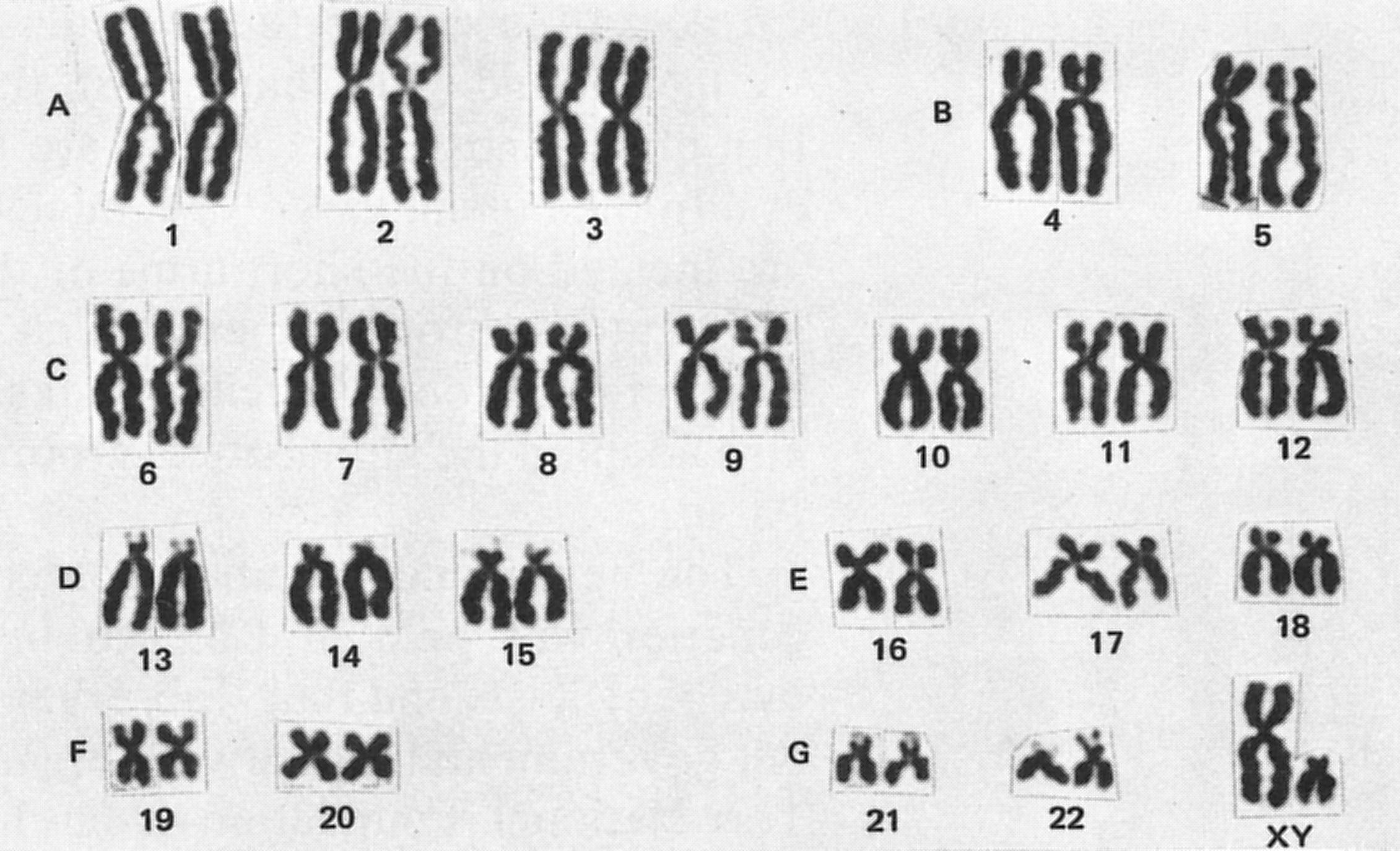В гаметах человека 23 хромосомы