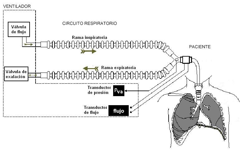 VENTILACIÓN MECANICA | Mapa Mental