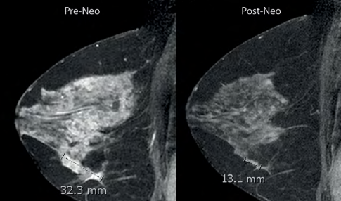 Different techniques of exploration of the breast and diagnostic ...