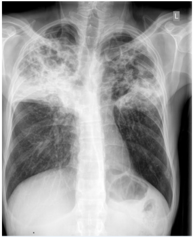 respiratory system iii | Quiz