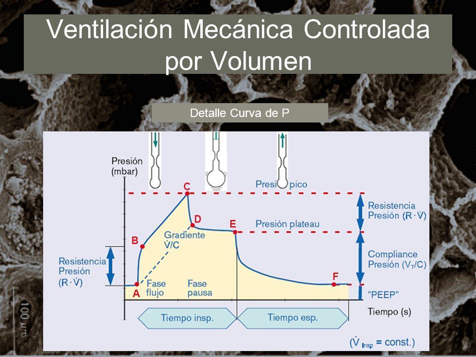 Modos De Ventilación Mecánica Conjunto De Fichas 8915