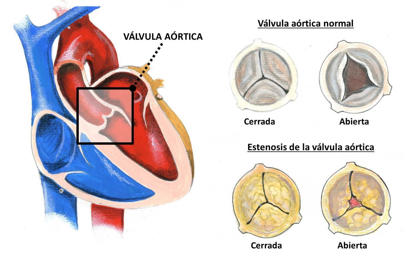 Mapa mental sobre las cardiopatías congénita Mind Map