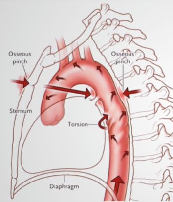 ATLS - Trauma Torácico | Mind Map