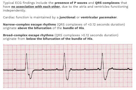 ECG Practice | Flashcards