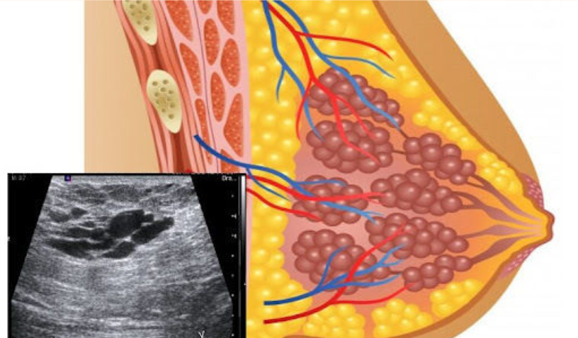 Different Techniques And Applications For The Diagnosis Of Breast