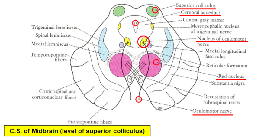 Sick sinus syndrome | Mind Map