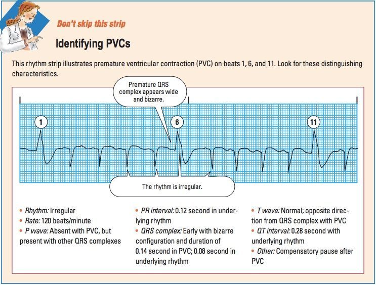 ECG Interpretation Note