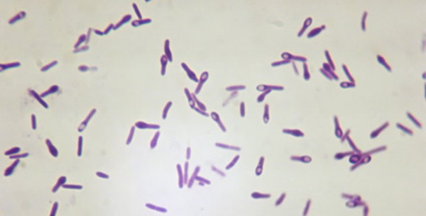 Clostridium Mapa Mental